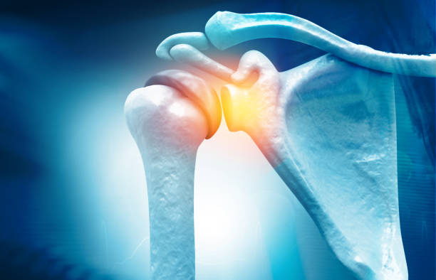 Read more about the article Frozen Shoulder – Causes and Treatment